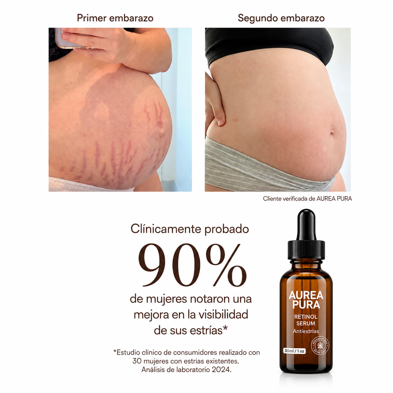 Aceite antiestrías AureaPura®